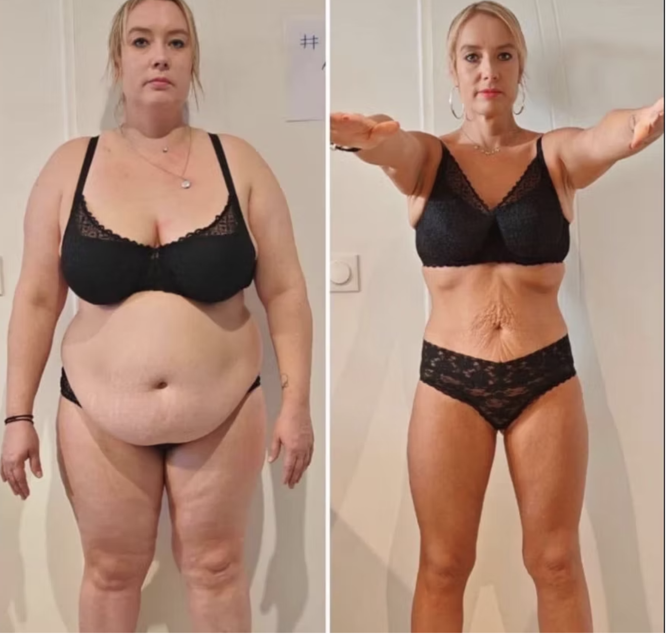 Transformation avant apr&egrave;s