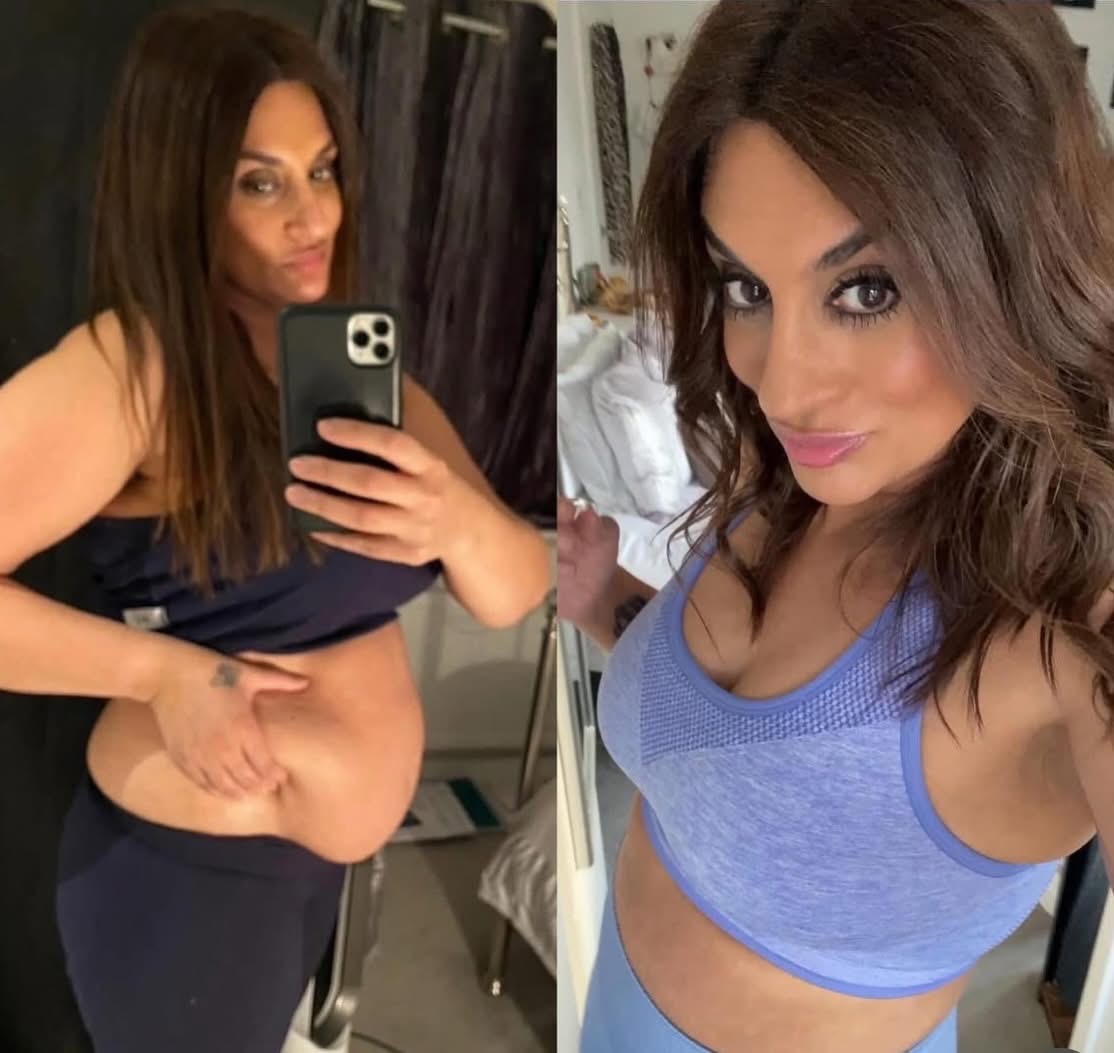 Transformation avant apr&egrave;s