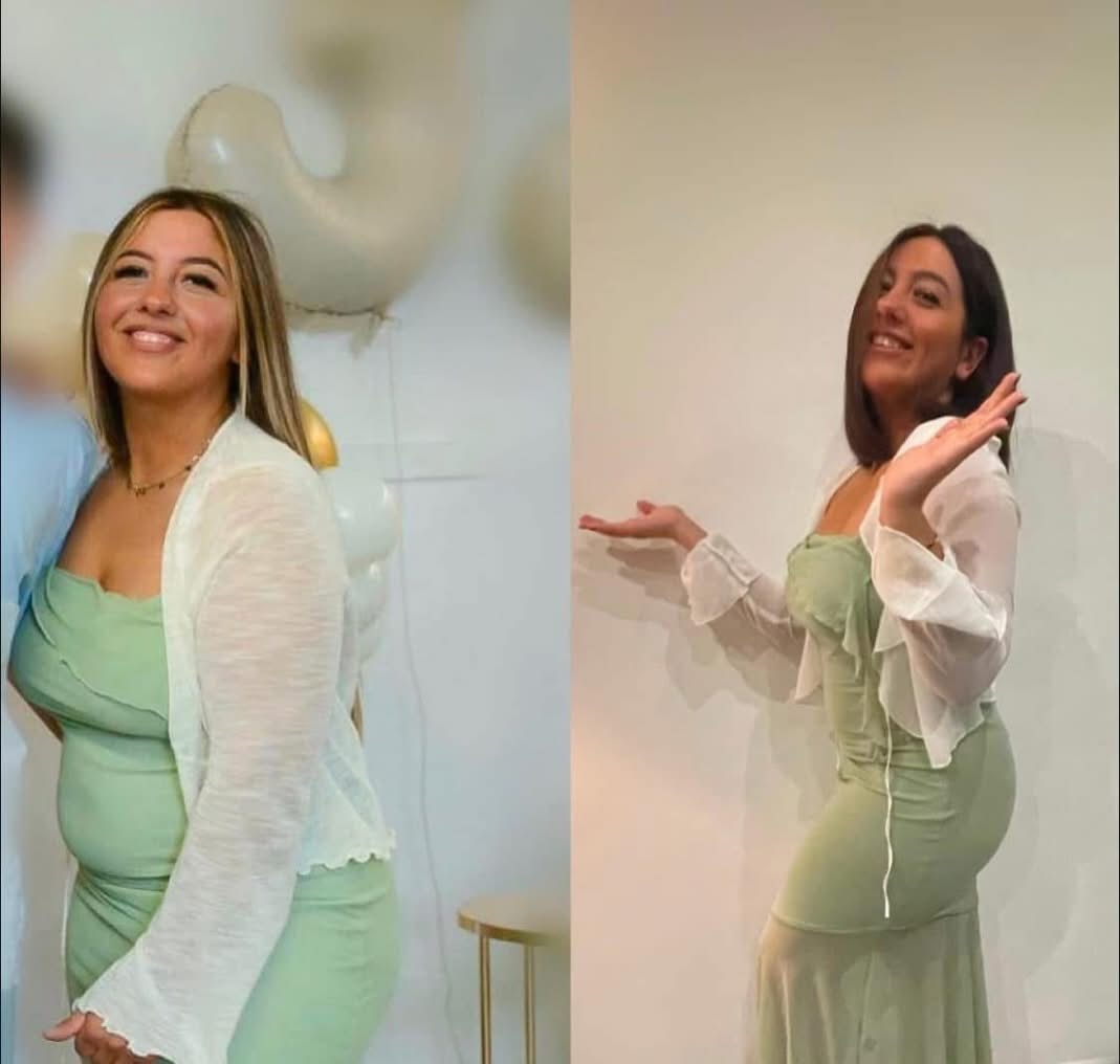 Transformation avant apr&egrave;s